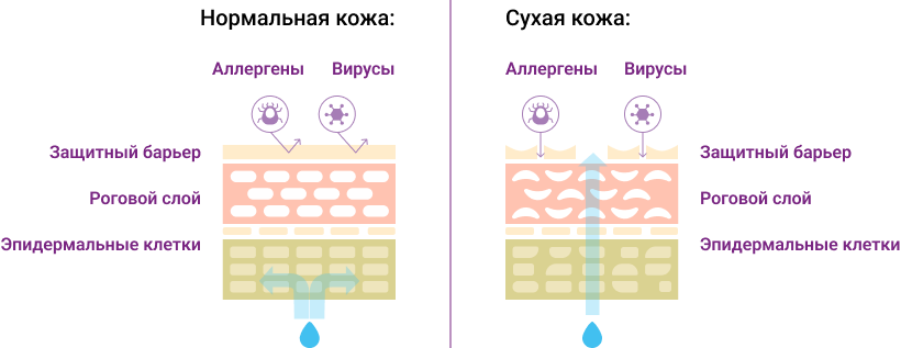 Сухая кожа ввиду железодефицита
